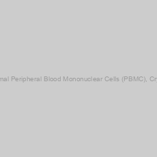 Image of Human Normal Peripheral Blood Mononuclear Cells (PBMC), Cryopreserved